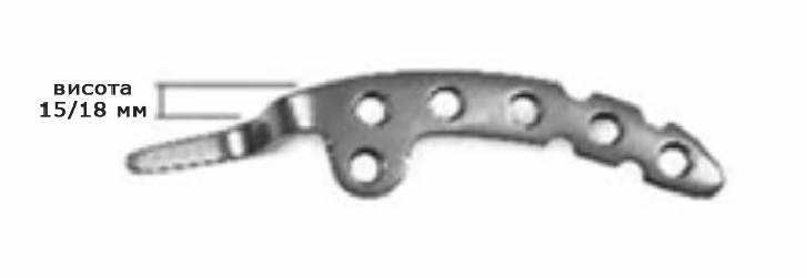 Гачкоподібна блокуюча пластина для ключиці UMP